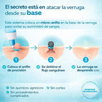 Kit completo para eliminar las verrugas en 1 semana